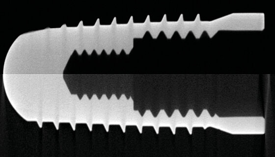 05.09.2023 | Neues zur Computertomografie - Genauigkeit hochgeschraubt