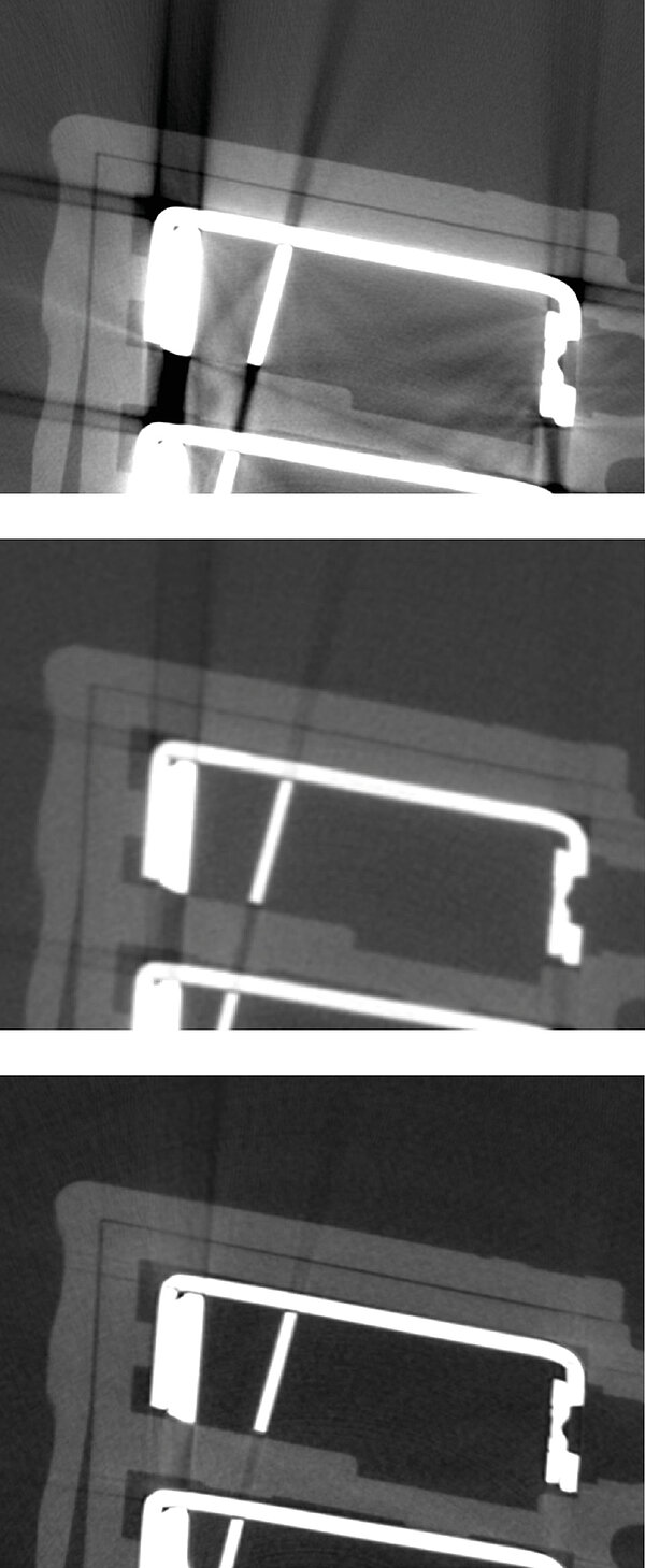 Neue Mehr-Spektren-Computertomografie